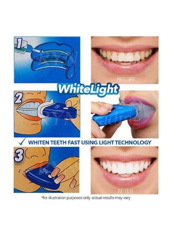 White Light Tooth Whitening System, 1 Piece