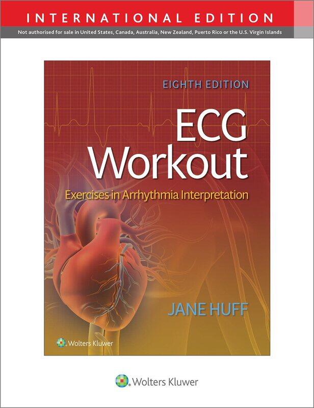 

ECG Workout: Exercises in Arrythmia Interpretation