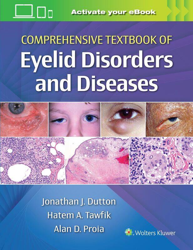 

Comprehensive Textbook of Eyelid Disorders and Diseases