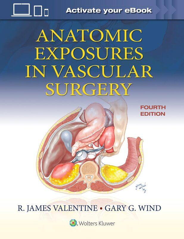 

Anatomic Exposures in Vascular Surgery
