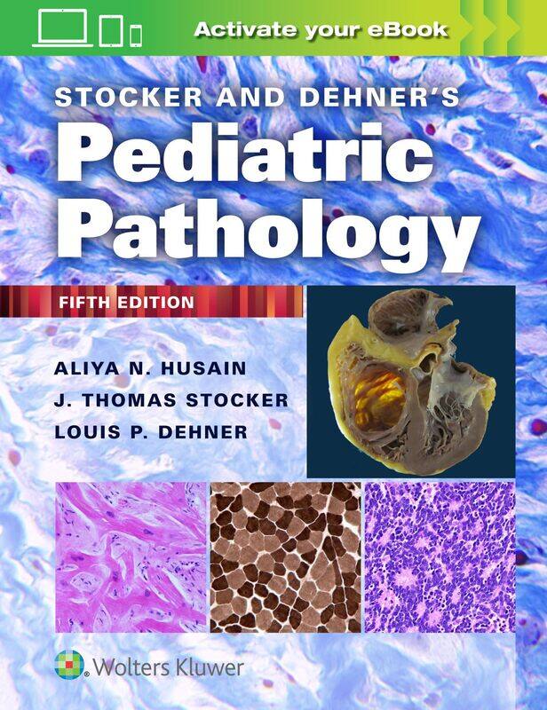 

WOLTERS KLUWER HEALTH Stocker and Dehner's Pediatric Pathology