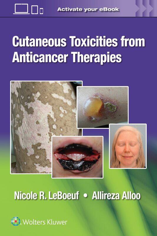 

Cutaneous reactions to anti-cancer therapies