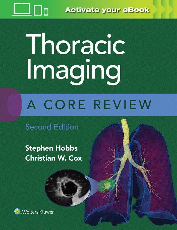 

WOLTERS KLUWER HEALTH Thoracic Imaging: A Core Review