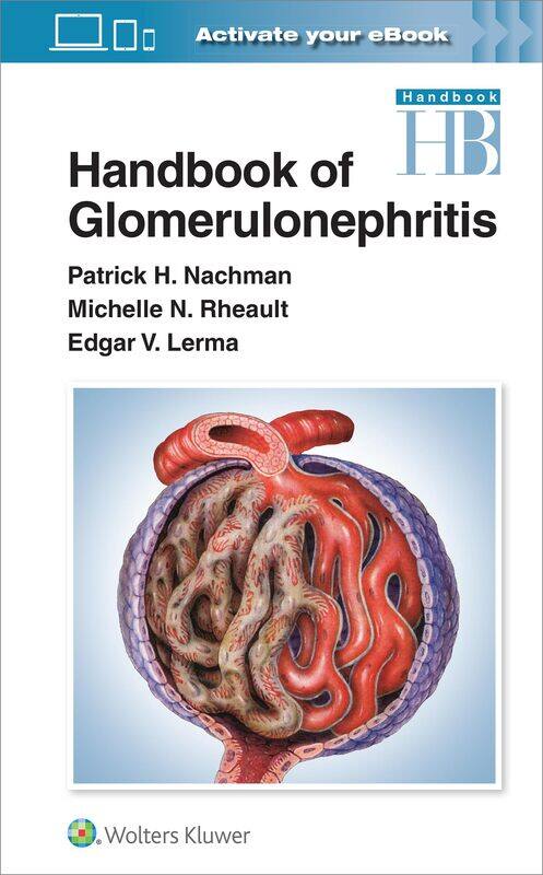 

Handbook of Glomerulonephritis