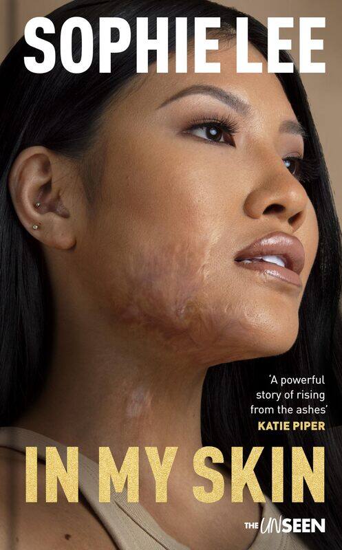 

In My Skin: Learning to love your perfectly imperfect life