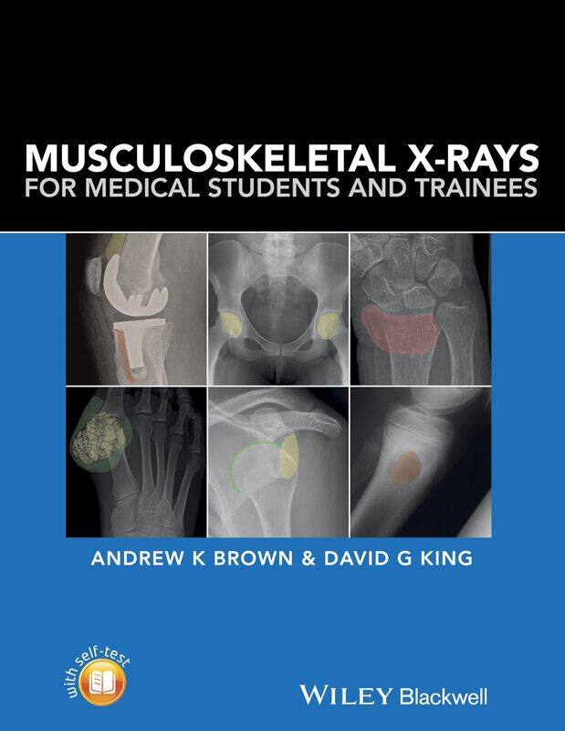 

WILEY Musculoskeletal X-Rays for Medical Students and Trainees