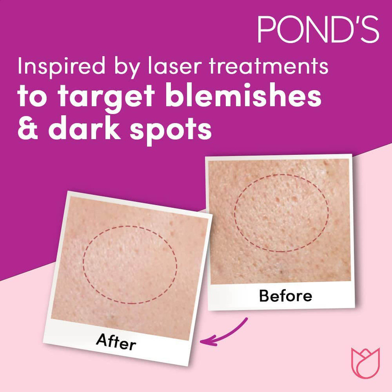 Pond's Flawless Radiance Derma + Night Cream - 50 g