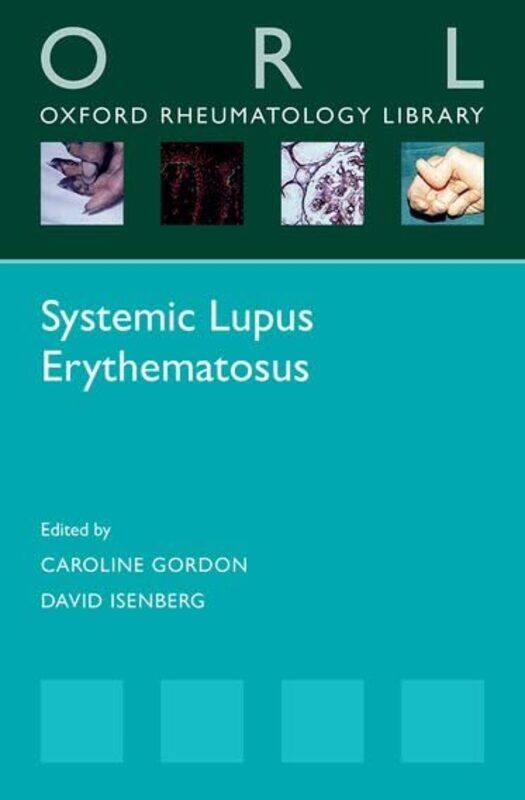 

Systemic Lupus Erythematosus by Ralph Metzner-Paperback