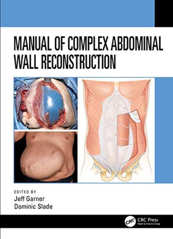 

Manual of Complex Abdominal Wall Reconstruction by Doggy Todays Doggy-Paperback