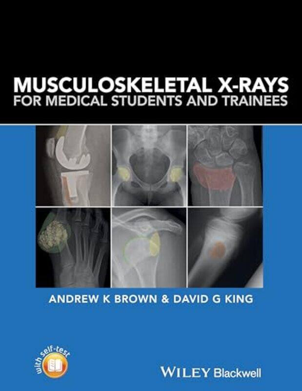 

Musculoskeletal XRays for Medical Students and Trainees by Hiroko Shirasaki-Paperback