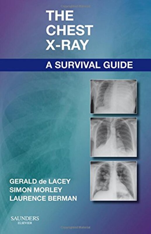 The Chest Xray A Survival Guide By de Lacey, Gerald, MA, FRCR (Consultant Radiologist to www.radiology-courses.com and formerly Consult Paperback