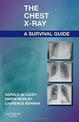 The Chest Xray A Survival Guide By de Lacey, Gerald, MA, FRCR (Consultant Radiologist to www.radiology-courses.com and formerly Consult Paperback