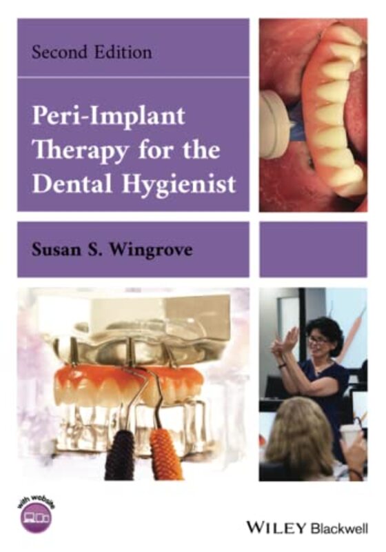 Peri-Implant Therapy for the Dental Hygienist , Paperback by Wingrove, Susan S. (The Implant Consortium, Missoula, MT)