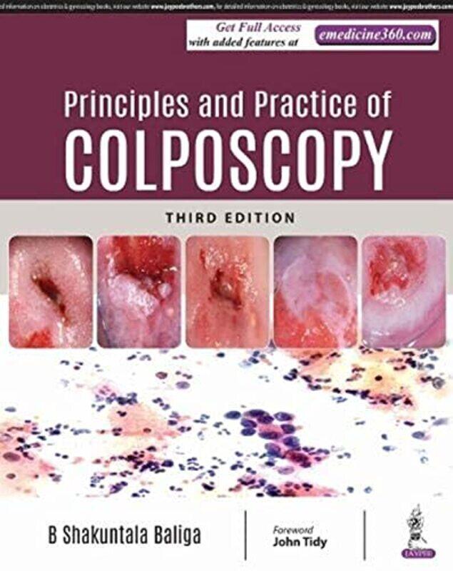 

Principles and Practice of Colposcopy , Hardcover by B Shakuntala Baliga
