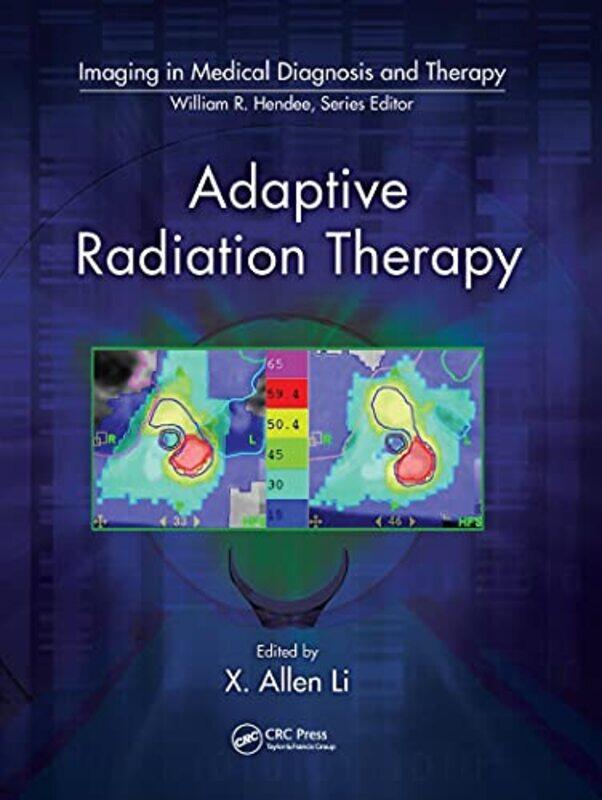 

Adaptive Radiation Therapy by Pieter Delft University of Technology The Netherlands SchavemakerLou Delft University of Technology The Netherlands van