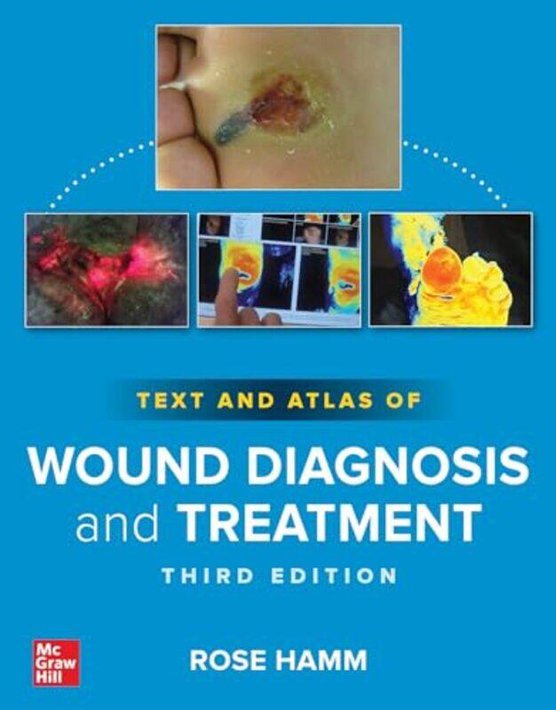 

Text and Atlas of Wound Diagnosis and Treatment Third Edition by Rose Hamm-Paperback