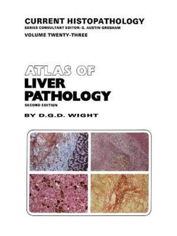 

Atlas of Liver Pathology,Paperback,ByWight, D.G.