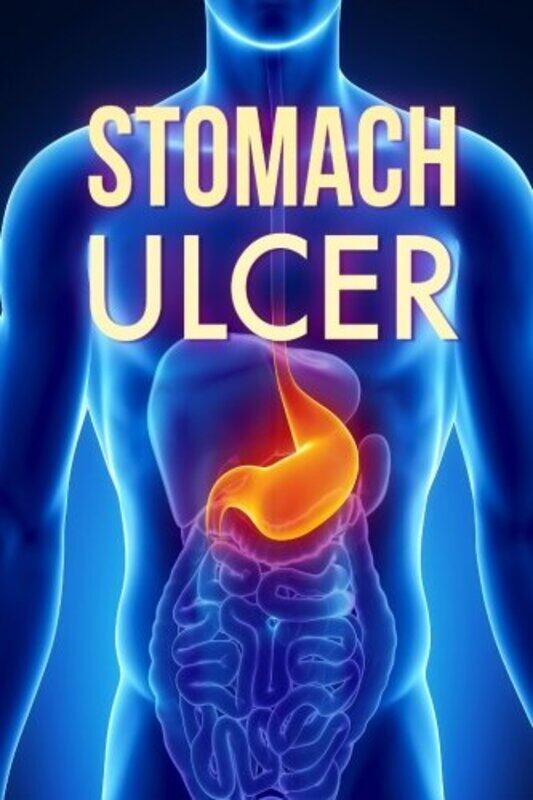 

Stomach Ulcer: Treatment in 60 days!: Stomach Ulcer treatment , Paperback by Jonathan, David L