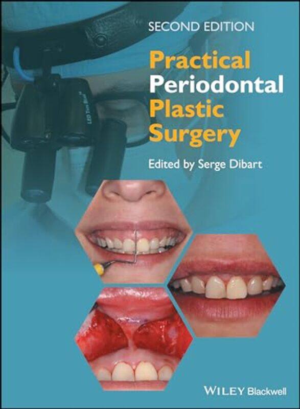 

Practical Periodontal Plastic Surgery by Serge (Boston University School of Dental Medicine) Dibart-Hardcover
