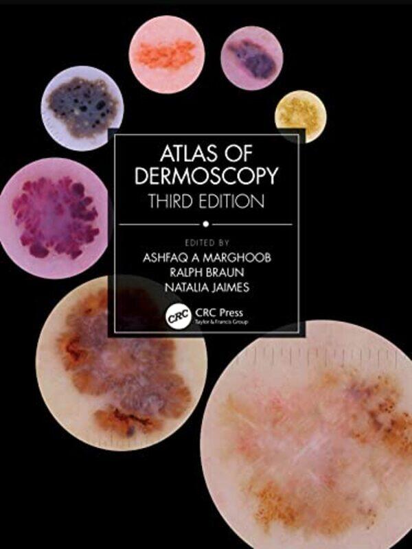 

Atlas of Dermoscopy by Glen B AllemanJon M Co-Founder Value Transformation LLC Texas USA Quigley-Hardcover