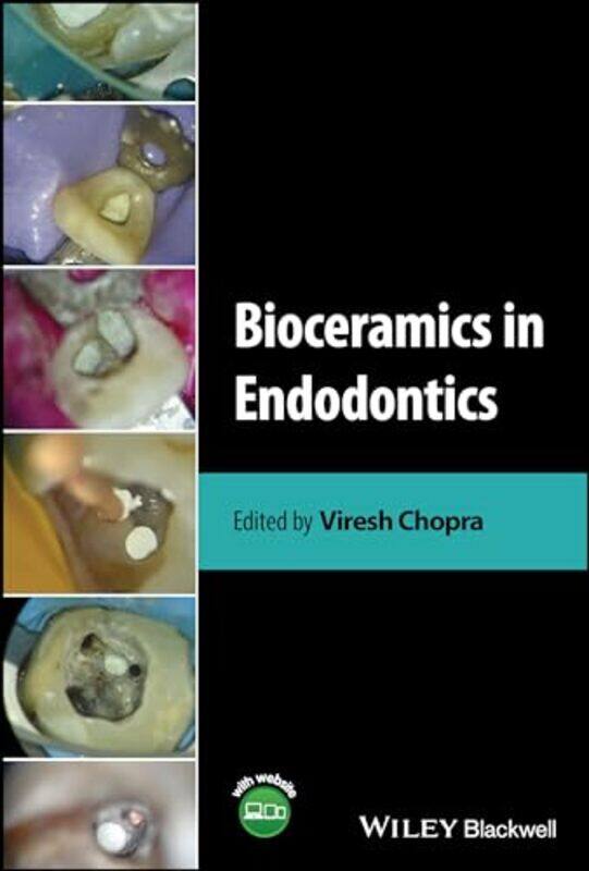 

Bioceramics In Endodontics by Viresh (Oman Dental College, Muscat, Oman; Queen Mary University, London, UK) Chopra-Hardcover