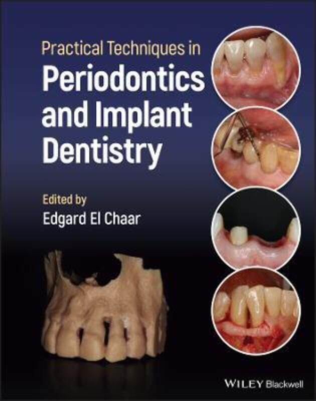 

Practical Techniques in Periodontics and Implant D entistry,Hardcover, By:El Chaar