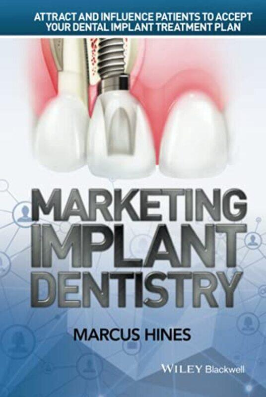 

Marketing Implant Dentistry Attract And Influence Patients To Accept Your Dental Implant Treatment By Hines, Marcus (Biohorizons Implant System, Md, U