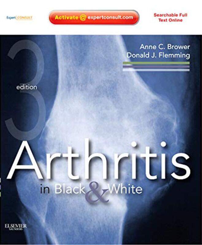 

Arthritis in Black and White by Visiting Assistant Professor Jeremiah W Grand Valley State University USA Cataldo-Hardcover