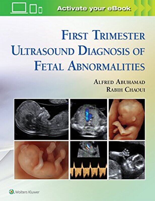

First Trimester Ultrasound Diagnosis of Fetal Abnormalities by Deborah HerridgeTanya Shields-Hardcover