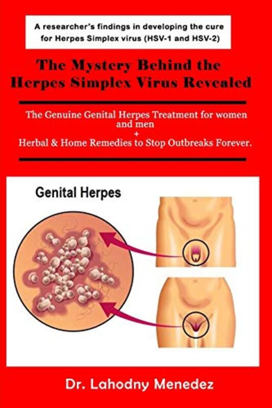 Mystery Behind the Herpes Simplex Virus Revealed , Paperback by Lahodny Menedez