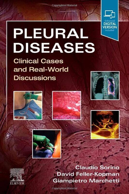 

Pleural Diseases by Richard F Katz-Paperback