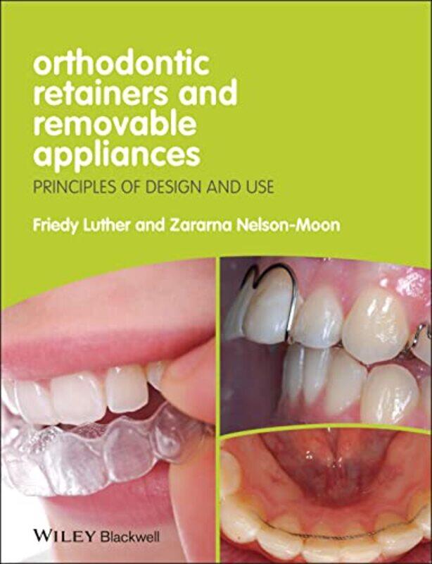 

Orthodontic Retainers and Removable Appliances Principles of Design and Use Paperback by Luther, K