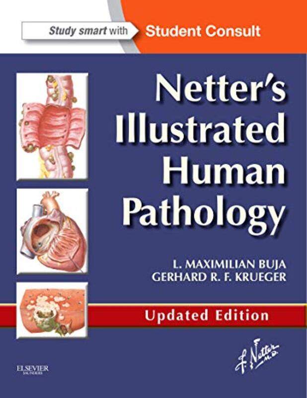 

Netters Illustrated Human Pathology Updated Edition by Chris Fitzgerald-Paperback