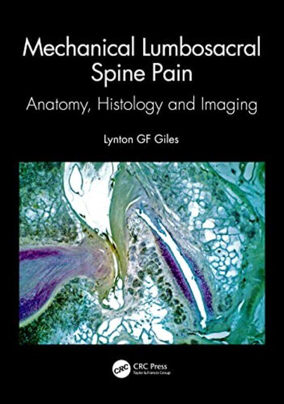 

Mechanical Lumbosacral Spine Pain by Lynton GF James Cook University, Queensland, Australia Giles-Paperback