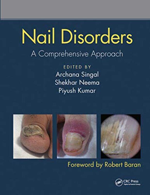 

Nail Disorders by Paul Bryn Davies-Paperback