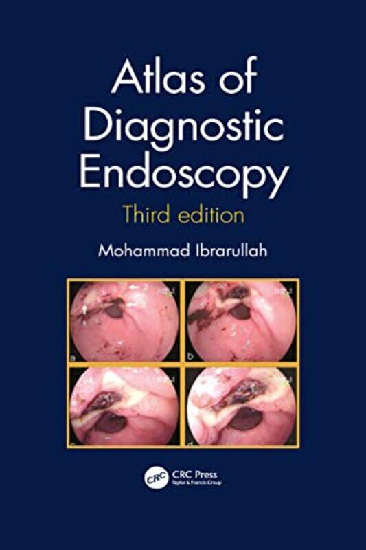 

Atlas of Diagnostic Endoscopy 3E by Mohammad Ibrarullah-Paperback