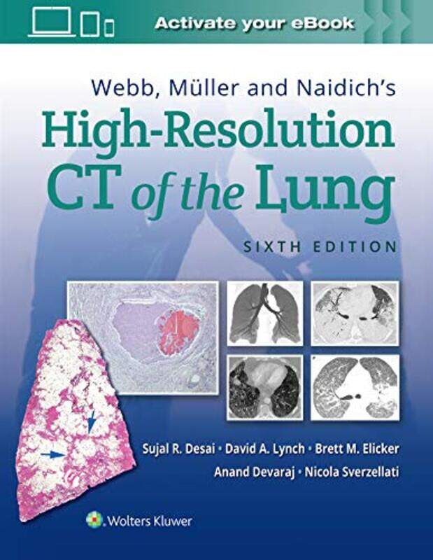 

Webb Muller and Naidichs HighResolution CT of the Lung by Jim Zub-Hardcover