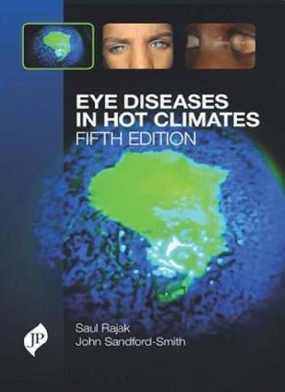 Eye Diseases in Hot Climates,Paperback,ByRajak, Saul N.