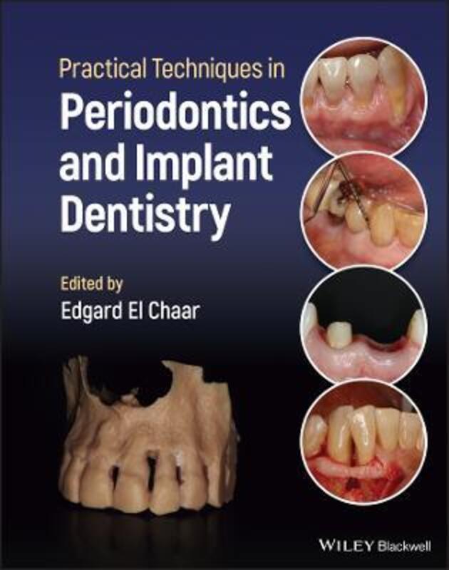 Practical Techniques in Periodontics and Implant D entistry,Hardcover, By:El Chaar