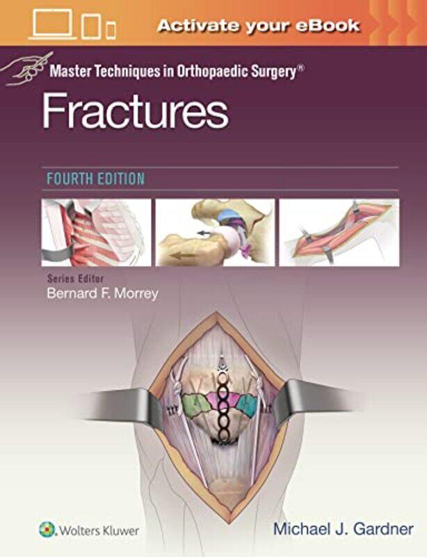 

Master Techniques in Orthopaedic Surgery Fractures by John Michael Greer-Hardcover
