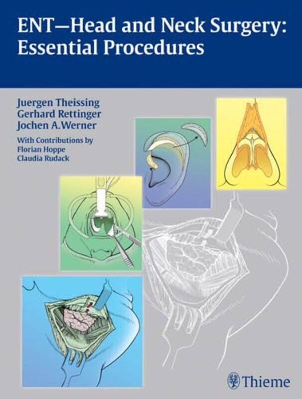 

ENT Head and Neck Surgery Essential Procedures by Joanne Ruelos DiazAnnelies Draws-Hardcover