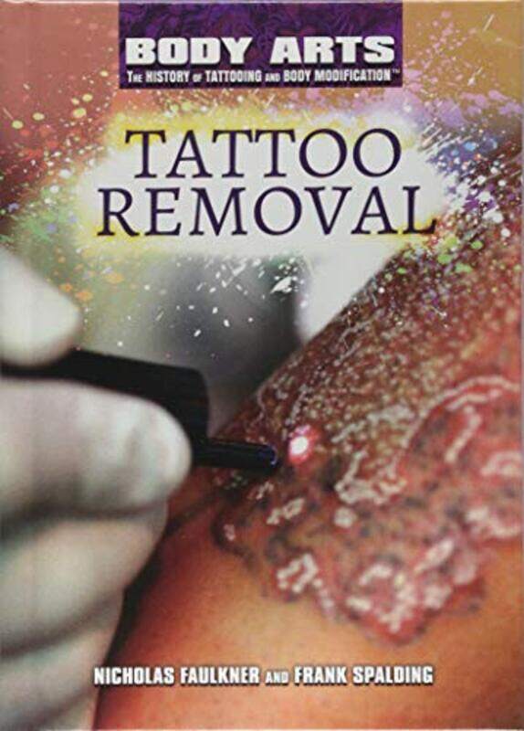 

Tattoo Removal , Hardcover by Faulkner, Nicholas - Spalding, Frank