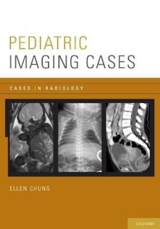 

Pediatric Imaging Cases, Paperback Book, By: Ellen Chung