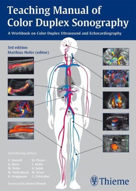 

Teaching Manual of Color Duplex Sonography by George Geary-Paperback