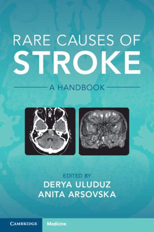 

Rare Causes of Stroke by Judy Parkinson-Paperback