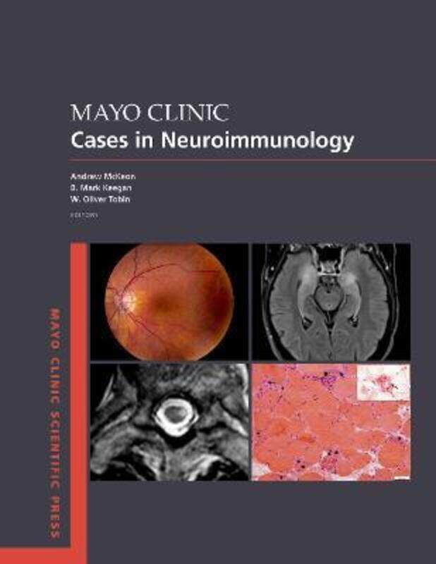 

Mayo Clinic Cases in Neuroimmunology.paperback,By :Andrew McKeon