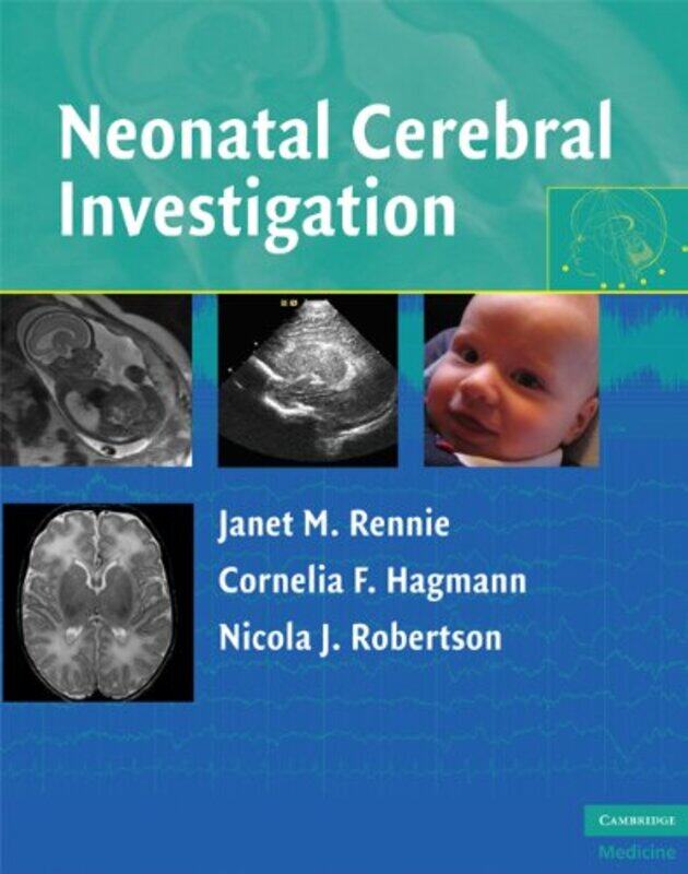 

Neonatal Cerebral Investigation by Insight Editions-Hardcover