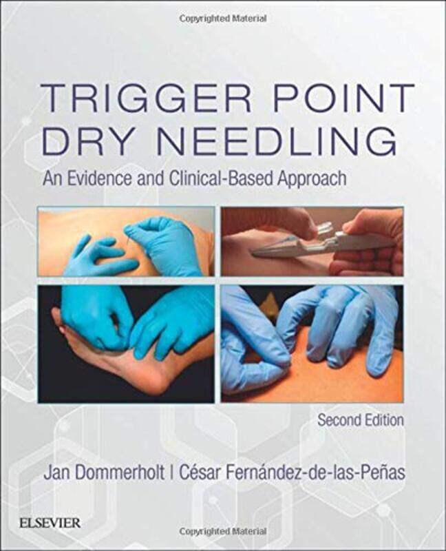 

Trigger Point Dry Needling , Hardcover by Jan Dommerholt
