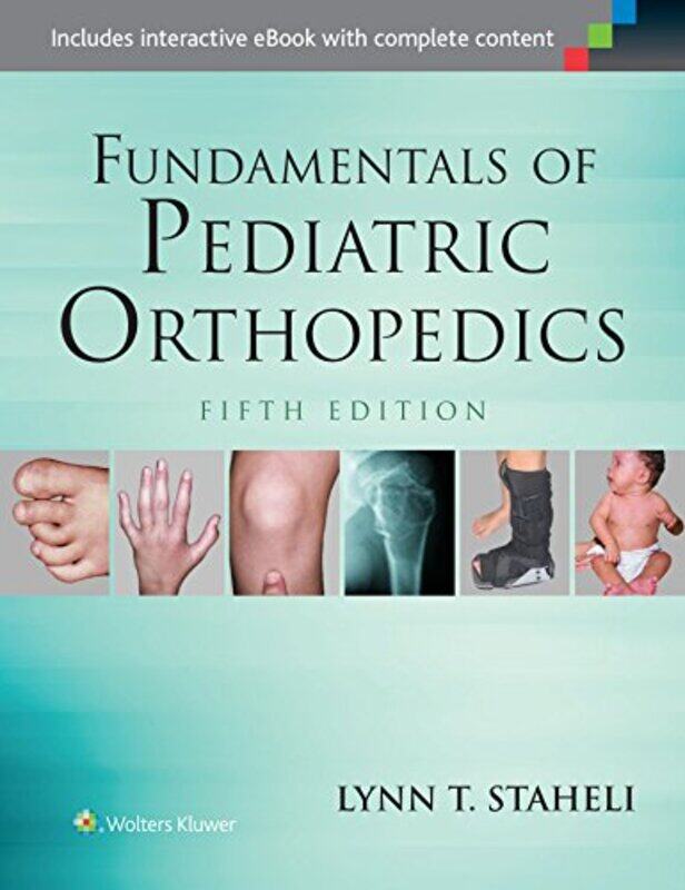 

Fundamentals of Pediatric Orthopedics by Louise ArcherJennifer DeWitt-Hardcover