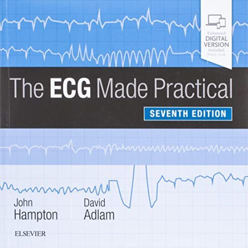 

The ECG Made Practical by David Souden-Paperback